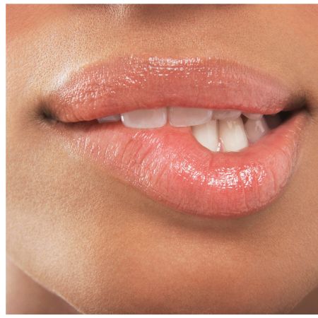 clinica oliva tratamiento labios