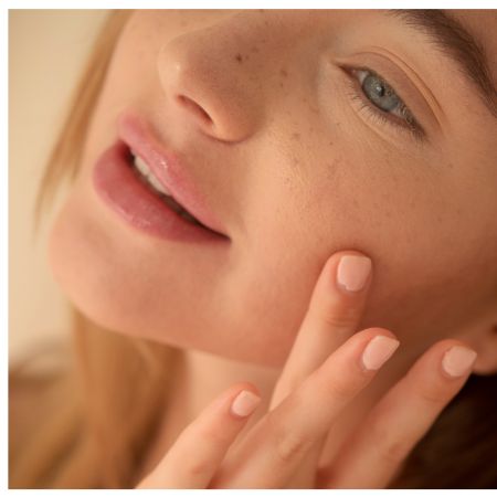 Tratamientro acido hialuronico