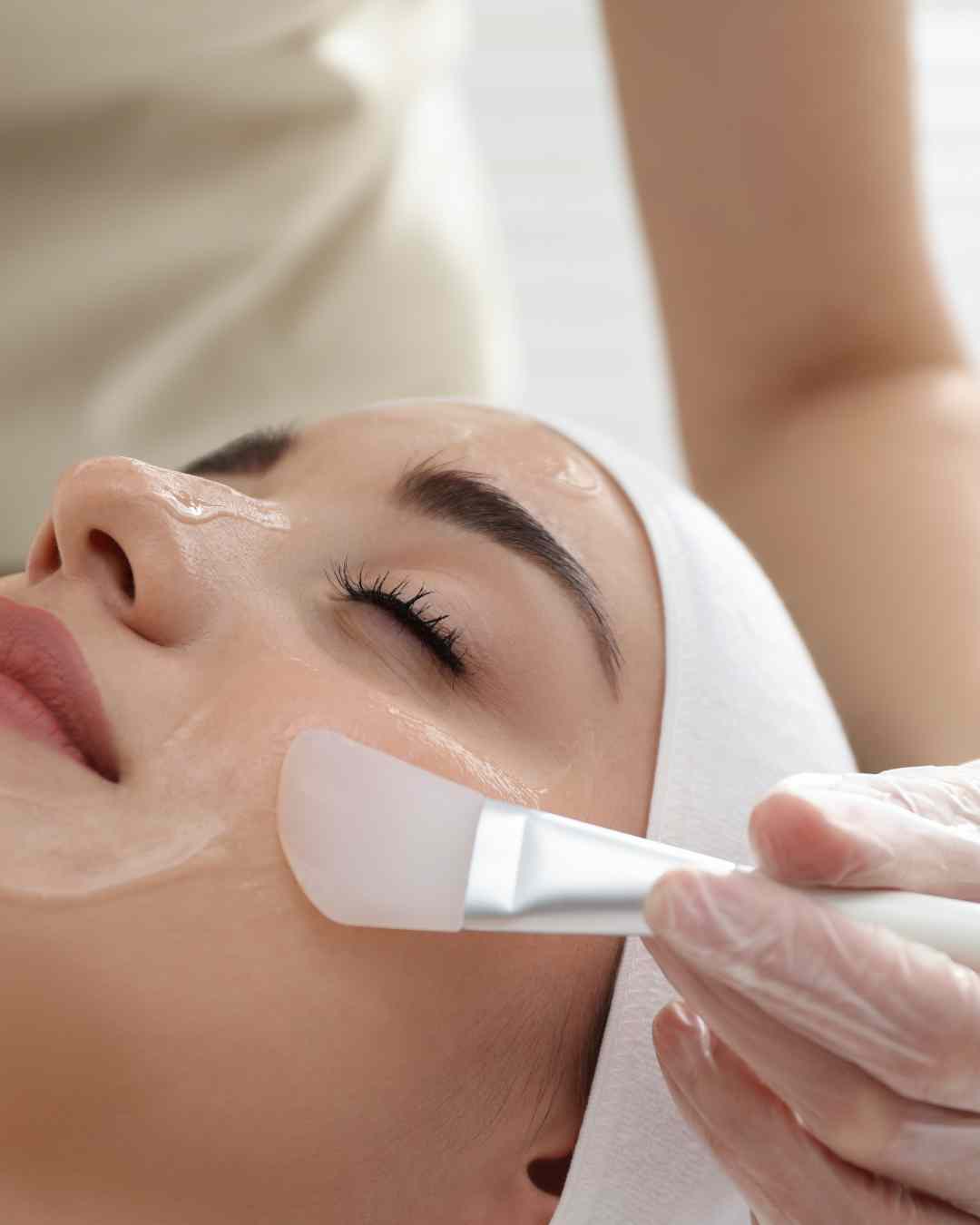 Peeling facial médico en Oliva (Valencia)